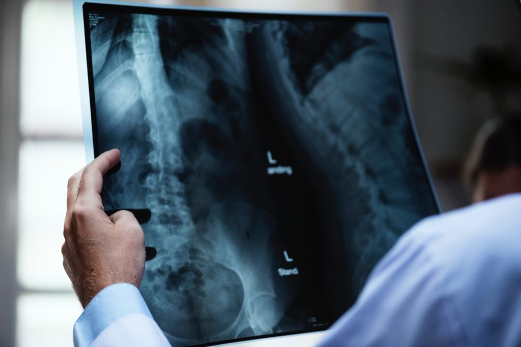 Chiropractic for Natural Healthcare