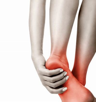 Chiropractic for Plantar Fasciitis